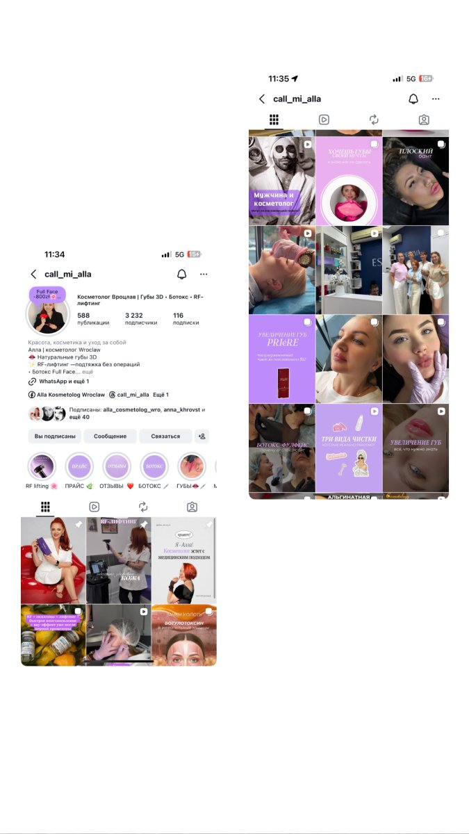 Instagram usług kosmetologicznych